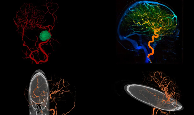 黑马破局！万东稀土悬吊DSA即将上市，挑战进口垄断